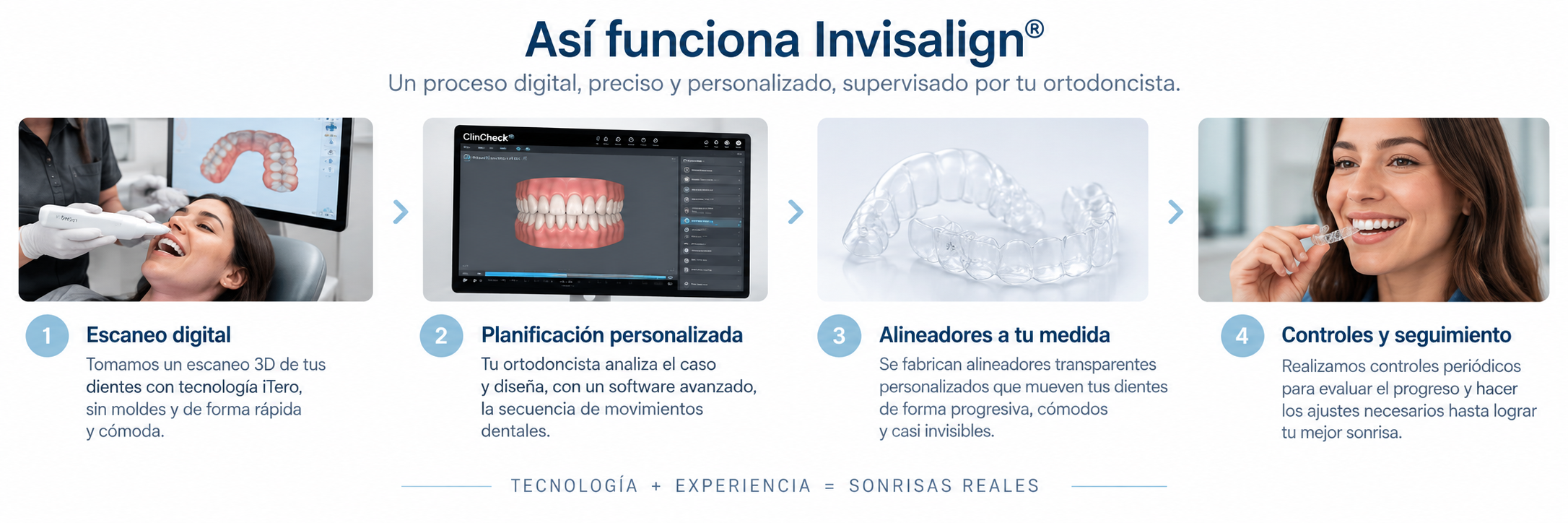Cómo funciona Invisalign con alineadores transparentes